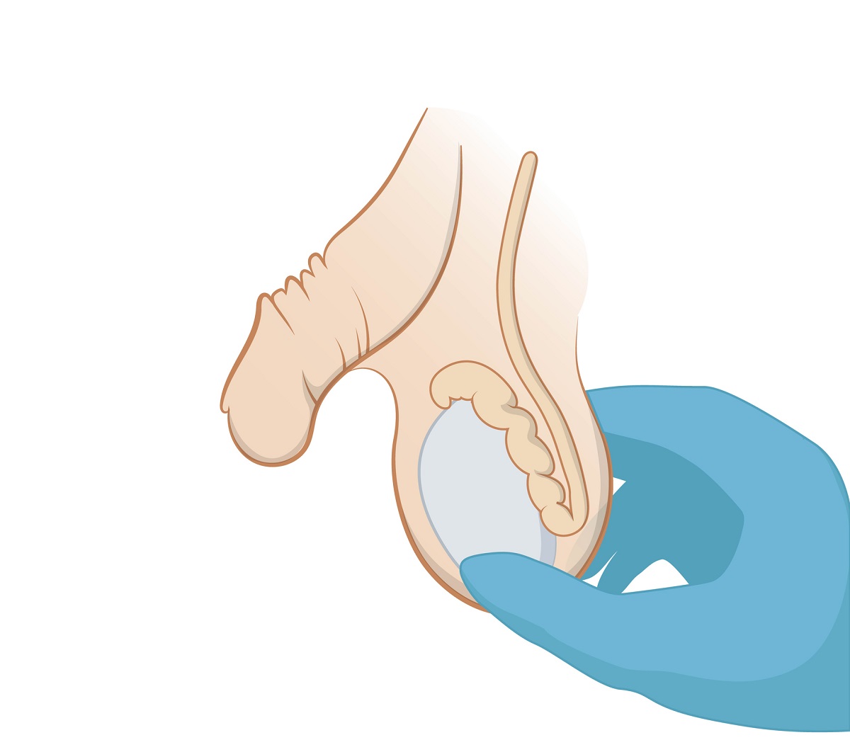 Pemeriksaan testis dengan palpasi